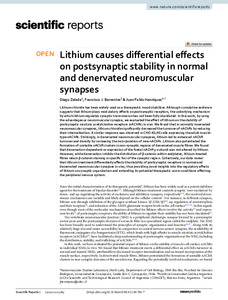 lithium-causes-differential.pdf.jpg